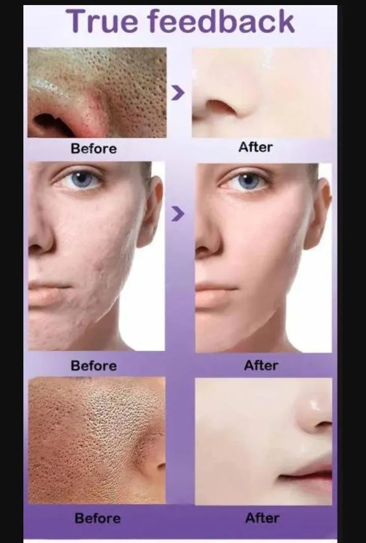 Uptown La Prevent Dryness And Dehydration Face Serum